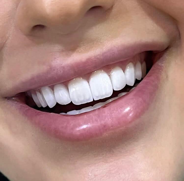 The Secret is Out: Syria's Rise as a Dental Tourism Powerhouse